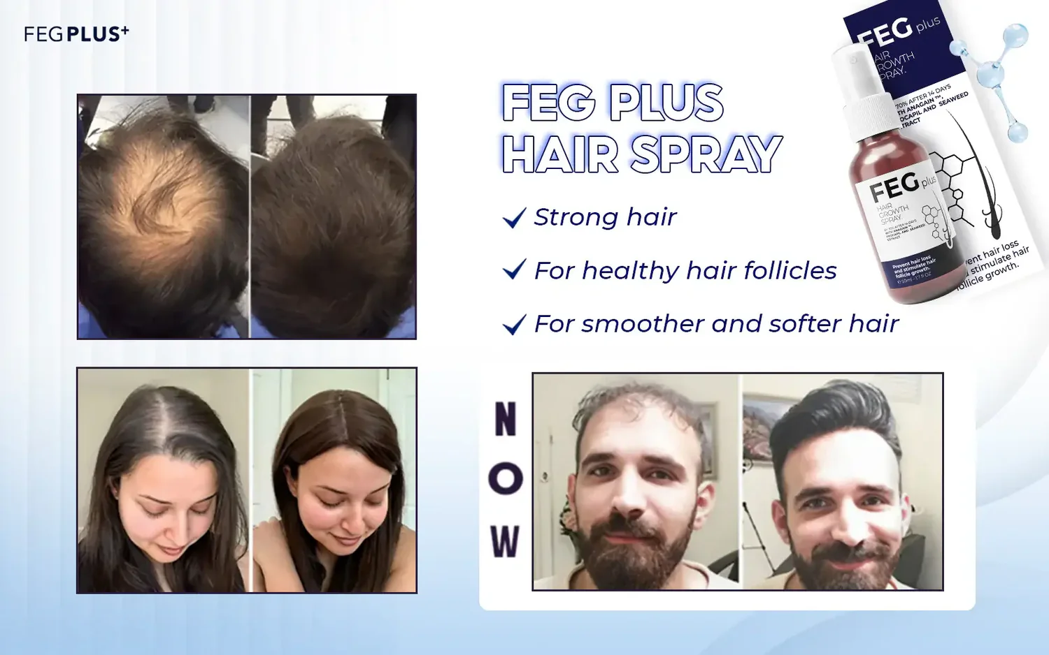FEG PLUS Beard & Hair Growth Serum Spray Powered by Nature for Visible Results | Best Quality Hair Growth Spray - Hair Serum - 50 ml - Image 7